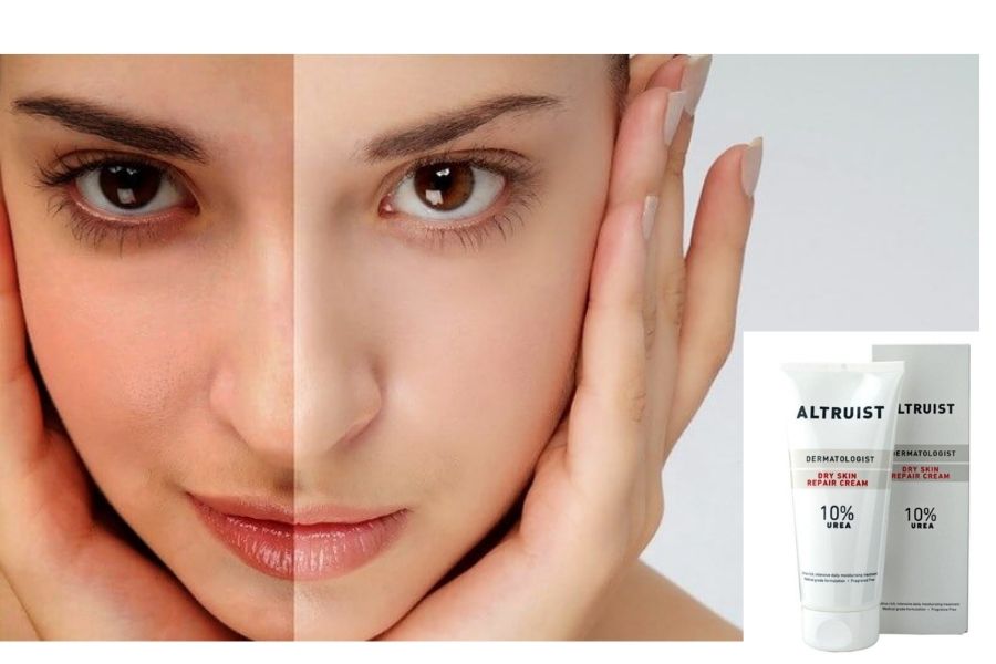 công dụng kem dưỡng Altruist Dry Skin Repair Cream