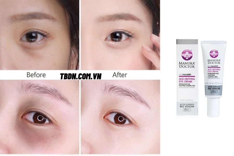 Công dụng kem dưỡng mắt Manuka Doctor Age-Defying Eye Cream