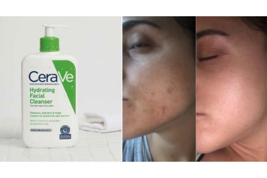 Công dụng sữa rửa mặt CeraVe Hydrating Cleanser cho da thường và da khô
